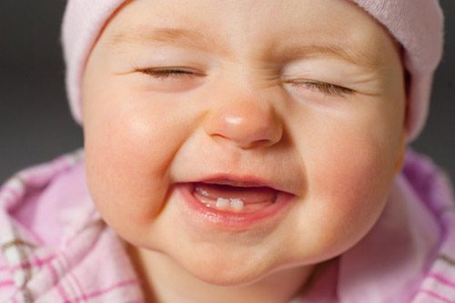 Hướng dẫn chữa đau do mọc răng mà không cần phải sử dụng tới thuốc