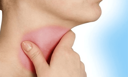 Nguyên nhân của bệnh viêm họng và hướng điều trị bệnh như thế nào?