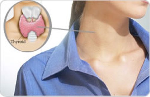Rối loạn tuyến giáp cũng là nguyên nhân khiến cơ thể lạnh