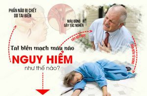 Thời tiết rét đậm cần có biện pháp phòng tránh đột quỵ