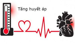 Tăng huyết áp có phải là rào cản của cuộc sống ?