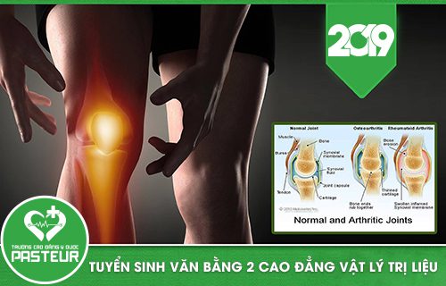 Tuyển sinh Văn bằng 2 Cao đẳng Vật  lý trị liệu năm 2019