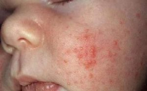 viem da e1546847752217