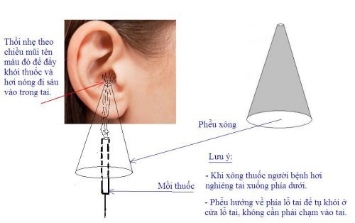 Nguyên tắc chung trong điều trị viêm tai giữa