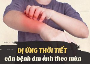 NhE1BBAFng bE1BB87nh thC6B0E1BB9Dng gE1BAB7p E1BB9F ngC6B0E1BB9Di di E1BBA9ng vE1BB9Bi thE1BB9Di tiE1BABFt 1