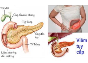 be1bb87nh vic3aam te1bba5y ce1baa5p