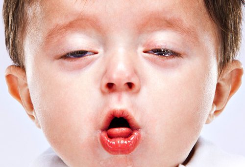 Tìm hiểu căn bệnh ho gà ở trẻ nhỏ