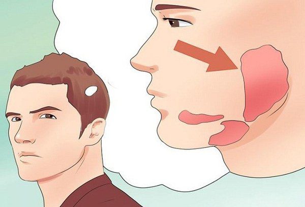 Phân biệt viêm tuyến nước bọt mang tai để điều trị