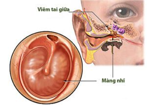 145160 viem tai giuataimuihongsg 1664964935776571382815 2