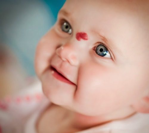 Bớt chàm đỏ thường có màu đỏ rất dễ nhận biết