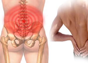 Phòng ngừa và điều trị bệnh đau thắt lưng cấp hiệu quả