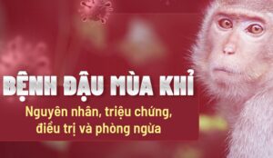 Bệnh đậu mùa khỉ: Biến chứng, phòng ngừa và cách điều trị