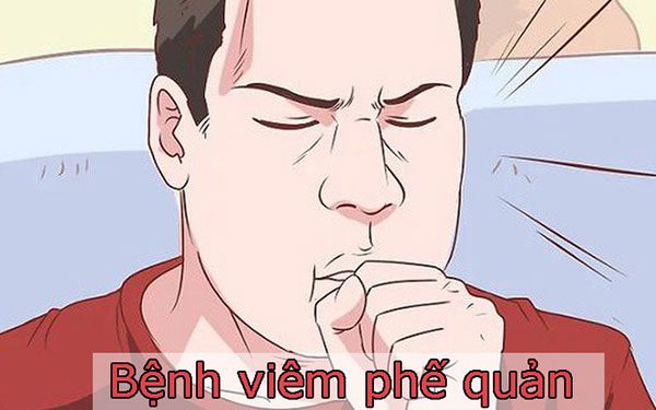 Biểu hiện của viêm phế quản
