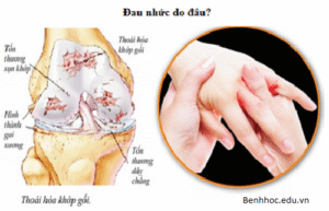 Dau nhuc xuong khop de tai phat vao mua lanh www.c10mt.com