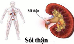 MC3A1ch bE1BAA1n mE1BB99t sE1BB91 mE1BAB9o tE1BBAB tE1BBB1 nhiC3AAn C491C3A1nh tan sE1BB8Fi thE1BAADn hiE1BB87u quE1BAA3 1