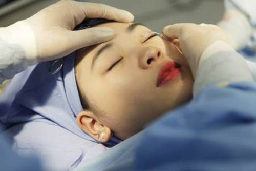 Tôi đã thực hiện bấm mí Hàn Quốc tại Viện thẩm mỹ Hà Nội