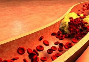 cac bai thuoc dong y tri mo mau cao 1200x686 1