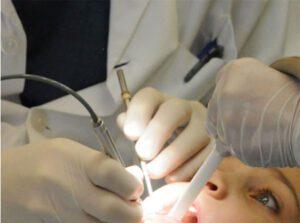 cach chua benh viem amidan qua phat hieu qua