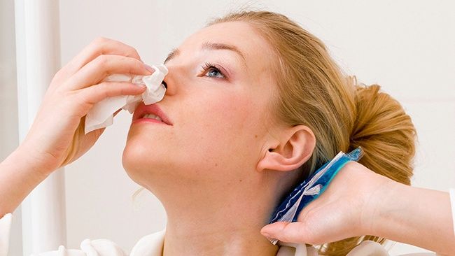 Triệu chứng điển hình huyết áp cao là chảy máu mũi