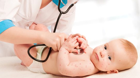 Thời tiết giao mùa là điều kiện cho bệnh chân tay miệng gia tăng ở trẻ