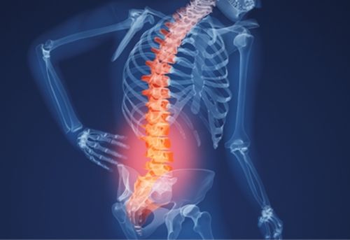 Bệnh thoái hóa cột sống và những điều  cần biết