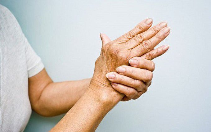 Viêm khớp dạng thấp cấp tính gây sưng, đỏ, đau nhức