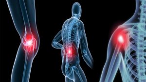 Những nguyên tắc nào cần thực hiện để bảo vệ xương khớp khỏe mạnh