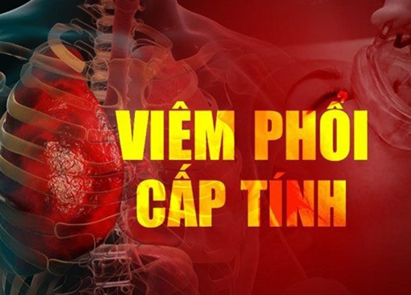 ViC3AAm phE1BB95i cE1BAA5p tC3ADnh cC3B3 thE1BB83 gC3A2y ra nhiE1BB81u biE1BABFn chE1BBA9ng nguy hiE1BB83m