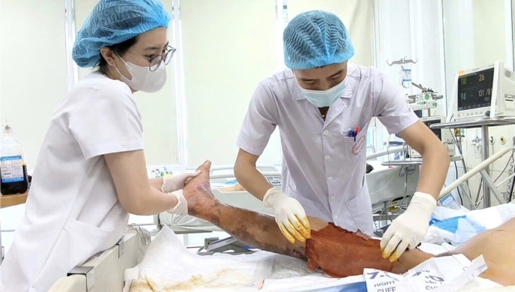 Sốc nhiễm trùng, suy đa tạng do chủ quan khi bị gai đâm 4 article 162