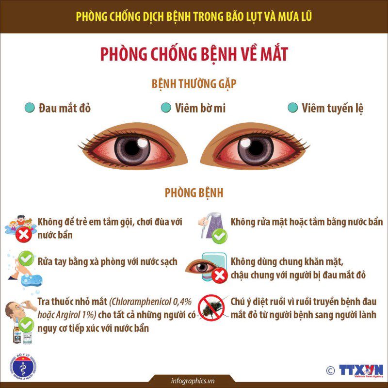 phong 3