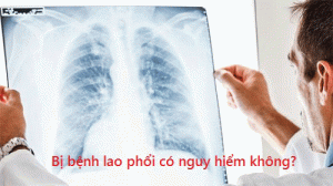 Tổng hợp thông tin đầy đủ nhất về bệnh lao phổi