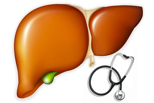 Cùng chuyên gia Điều dưỡng Hà Nội tìm hiểu bệnh suy gan
