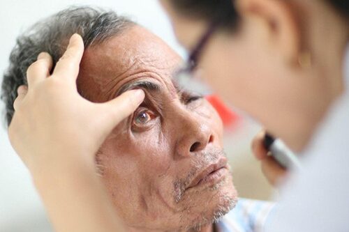 Mọi người cần làm gì để kiểm soát các biến chứng do bệnh tiểu đường