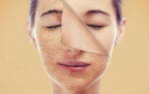 Khi tẩy tế bào chết cho da mặt bạn phải ghi nhớ những lưu ý sau