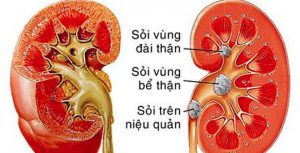 soi than 1461839608875 80 0 421 669 crop 1461839877235