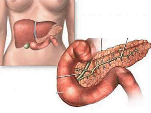 Triệu chứng của bệnh viêm tụy cấp là gì?