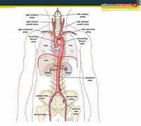 Sinh lý bệnh hẹp eo động mạch chủ là gì?