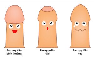 chuyen gia benh chuyen khoa tu van ve chung benh hep bao quy dau 2