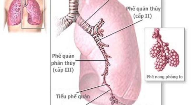 dieu-tri-gian-phe-quan