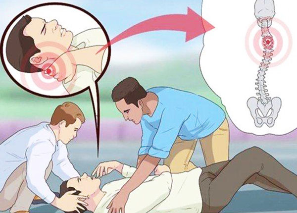 Gãy cột sống là một chấn thương nặng, có thể đe dọa đến tính mạng.