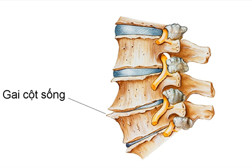 Dược sĩ cho biết những nguyên tắc dinh dưỡng của bệnh Gai cột sống