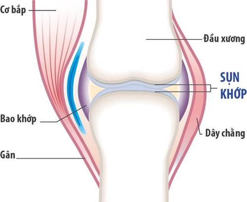 Cách ngừa đau khớp vào thời điểm giao mùa hiệu quả