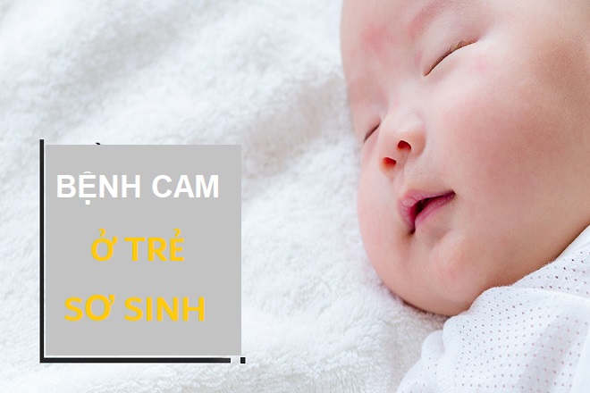 cam nhiet 1