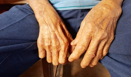 Chăm sóc bệnh nhân phong như thế nào?