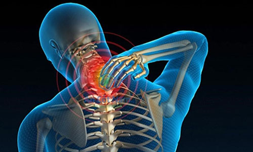 Chứng mất ngủ là hậu quả do thoái hóa đốt sống cổ ?
