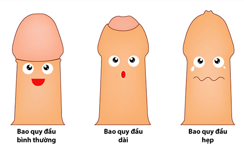 chuyen gia benh chuyen khoa tu van ve chung benh hep bao quy dau