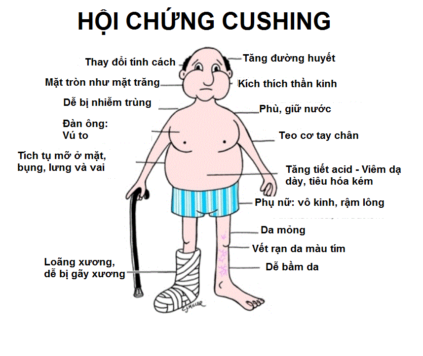 cushing