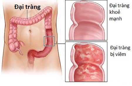 dai-trang-man-tinh