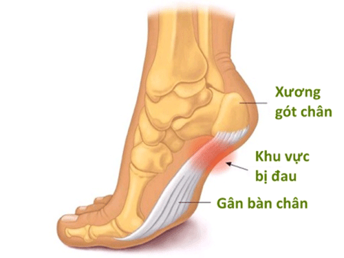 dau got chan 1