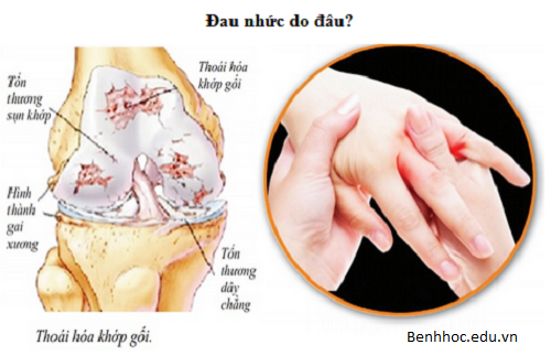 Dau-nhuc-xuong-khop-de-tai-phat-vao-mua-lanh-www.c10mt.com